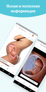 Беременность + скриншот 6