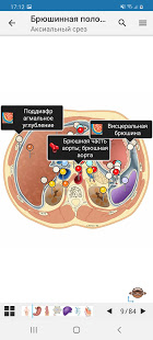 e-Anatomy скриншот 3