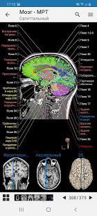 e-Anatomy скриншот 4